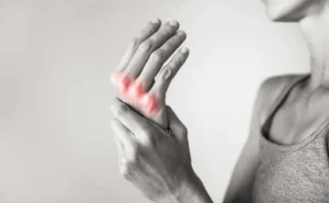 CBD-Öl bei Arthritis: Natürliche Schmerzlinderung
