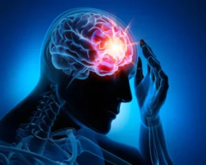 CBD-Öl zur Unterstützung bei Epilepsie